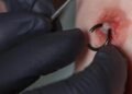 How to Reduce Nipple Piercing Pain Safely: Lidocaine Spray and Aftercare Strategies